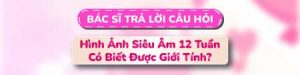 Câu hỏi 1