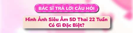 Câu hỏi 2